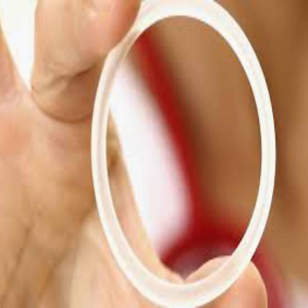 anillo anticonceptivo